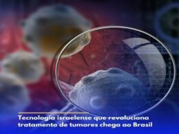Tecnologia israelense que revoluciona tratamento de tumores chega ao Brasil