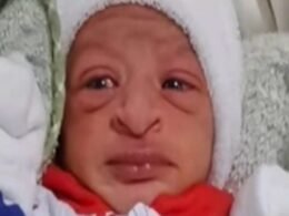 De “feinho” a encantador: A transformação do menino Miguel que divertiu a web