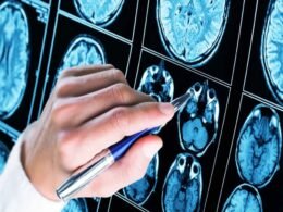 Novo teste de rastreio ocular detecta autismo em bebês em 15 minutos com 80% de precisão