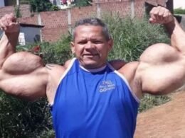 Morre Arlindo Anomalia, o “Popeye Brasileiro”